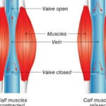 Calf Muscle Pump is Second heart